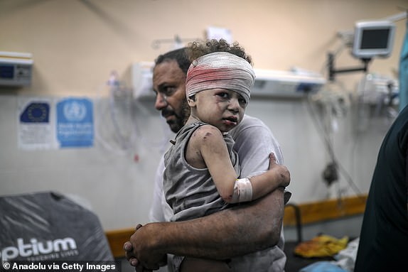 KHAN YUNIS, GAZA - OCTOBER 19: An injured child is brought to the Nassr hospital after the Israeli airstrikes in Khan Yunis, Gaza on October 19, 2023. (Photo by Belal Khaled/Anadolu via Getty Images)