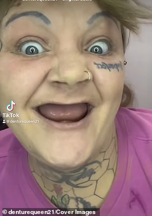 She was forced to wear dentures after losing her teeth. She's seen here with her toothless look