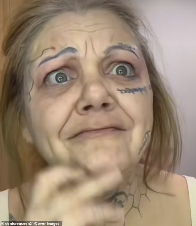 Jessica's journey took a unique twist when she discovered TikTok. She started documenting her dentures experiences and sharing her story with the world
