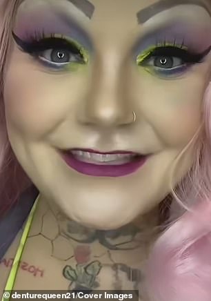 Pictured is her transformation with her dentures in