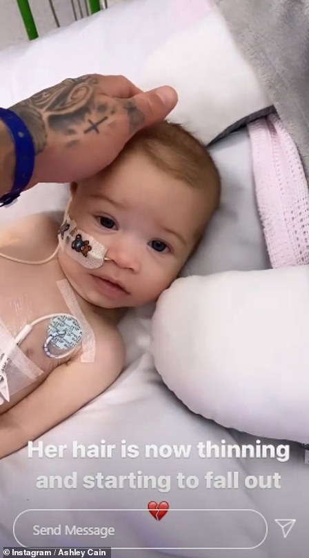 So sad: Azaylia's hair started to fall out just weeks after she was diagnosed in November