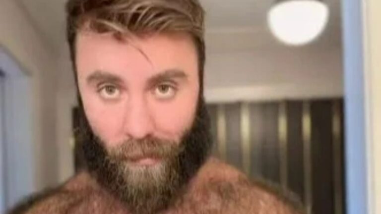 I’m so hairy I’m known as Mr Teddy Bear – trolls call me ‘dirty’ and think I have a sweater on – I don’t care, I love it