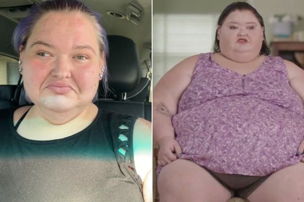 1000-lb Sisters Amy Slaton admits she has 'low self esteem' despite 176lb weight loss 1000-lb Sisters Amy Slaton admits she has 'low self esteem' despite 176lb weight loss