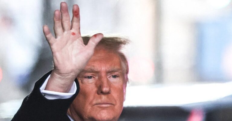 Donald Trump reveals what caused those strange red marks on his hand | US News Donald Trump reveals what caused those strange red marks on his hand | US News